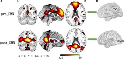 Altered Default Mode Network Dynamics in Civil Aviation Pilots